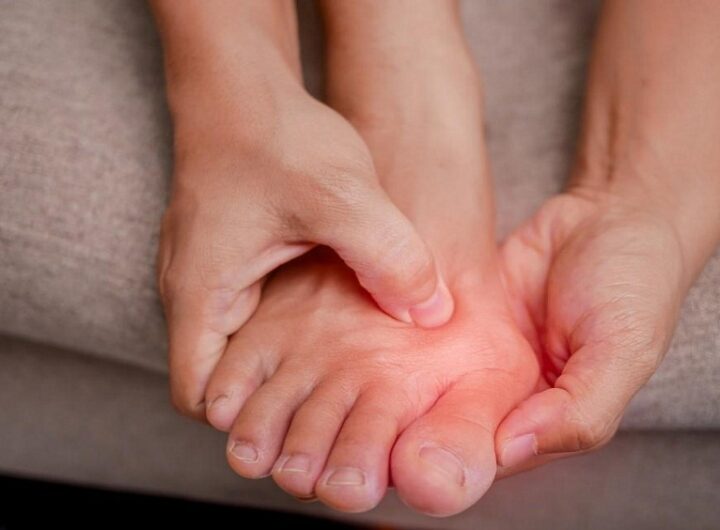 Podiatry And Rheumatoid Arthritis