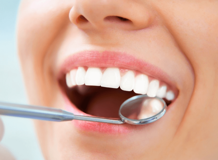 Dentist Can Help You Prevent Tooth Erosion