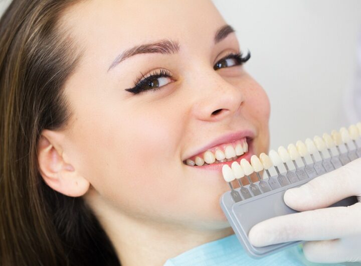 Cosmetic Dentistry