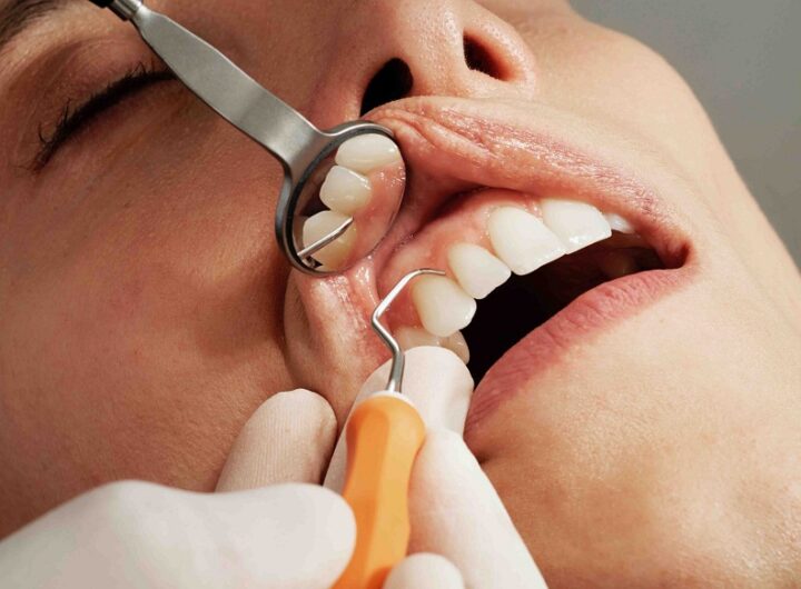 cosmetic dentistry